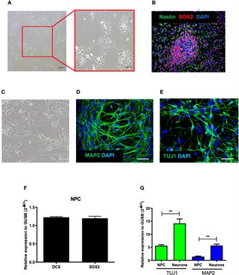 Betulinic Acid Exerts Cytoprotective Activity on Zika Virus-Infected Neural Progenitor Cells